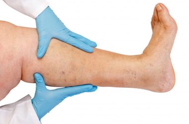 doctor checking for lower limb disease