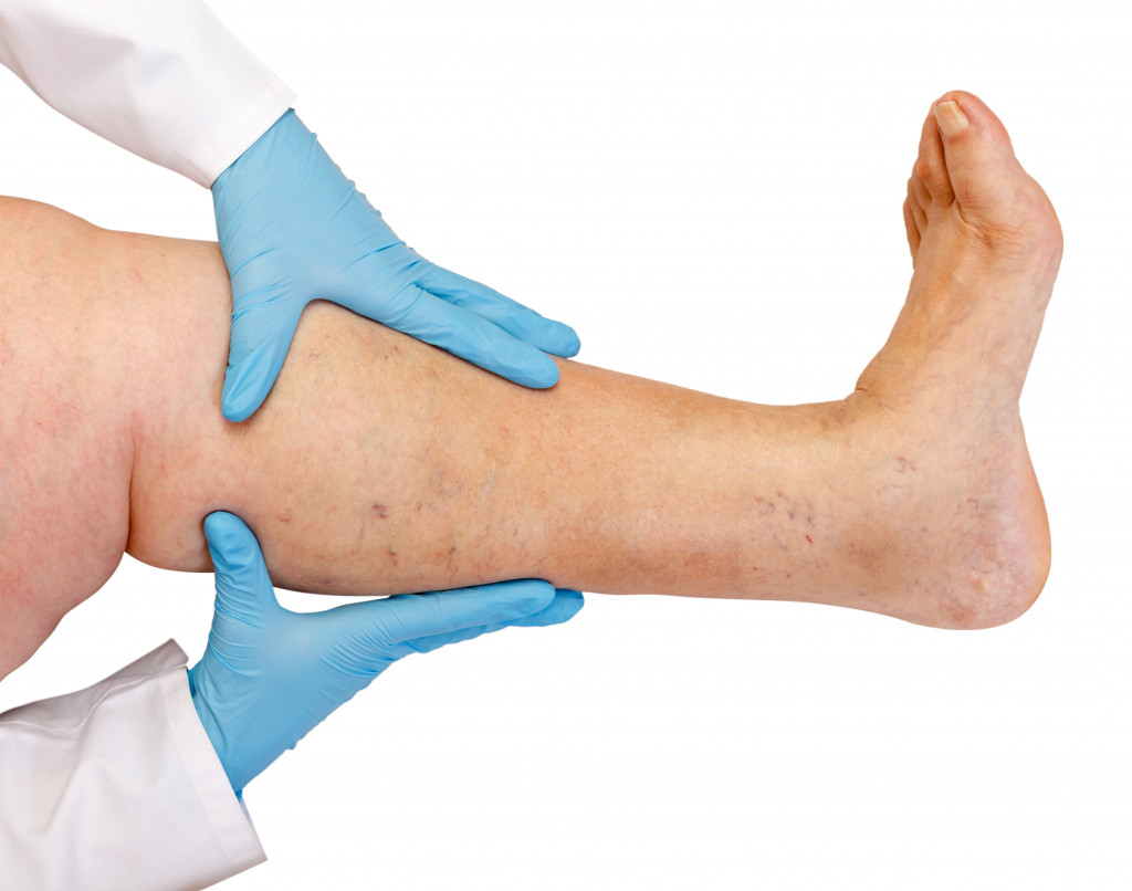 doctor checking for lower limb disease